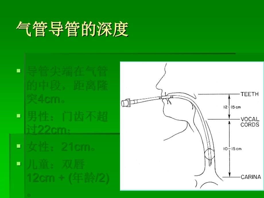 气管插管及困难气道_第5页