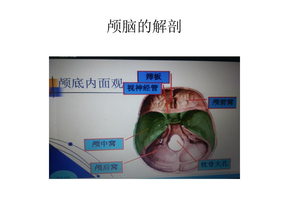 神经外科护理细节ppt课件_第3页