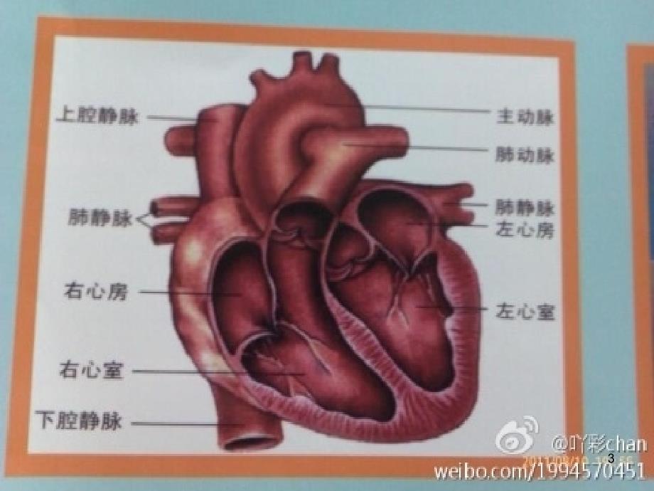 室间隔缺损护理查房及疾病介绍ppt课件_第3页