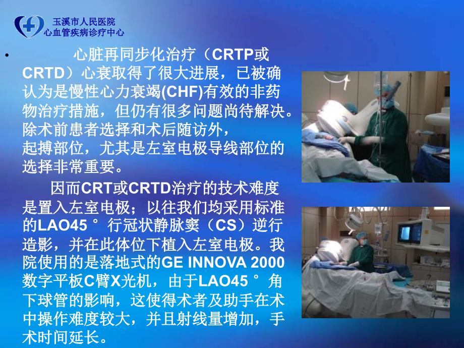 最新左室电极植入时不同投射角度的应用PPT课件_第2页