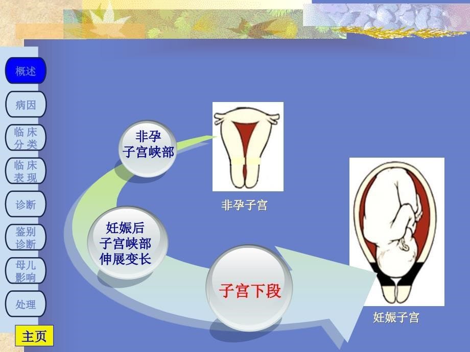 前置胎盘PPT课件_第5页