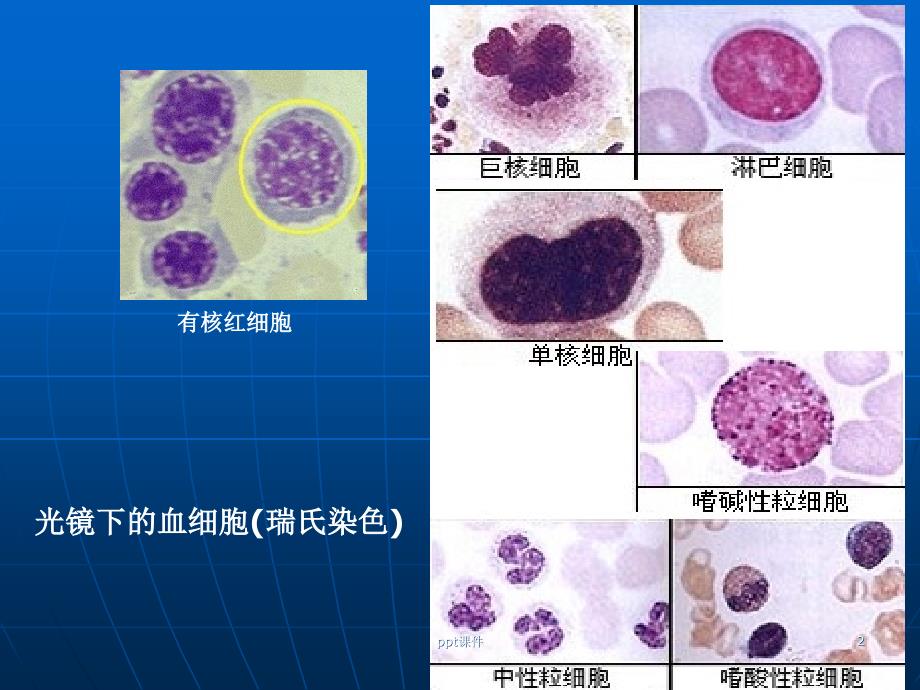 白细胞减少症--ppt课件_第2页