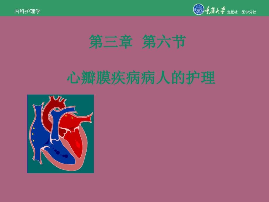 内科护理学第三章第六节心瓣膜病病人的护理ppt课件_第1页