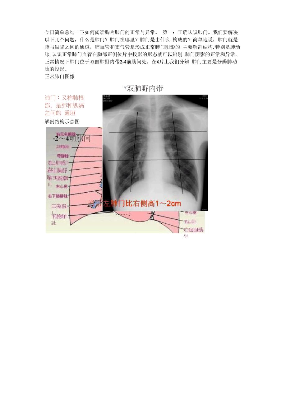 肺门学习小结_第1页