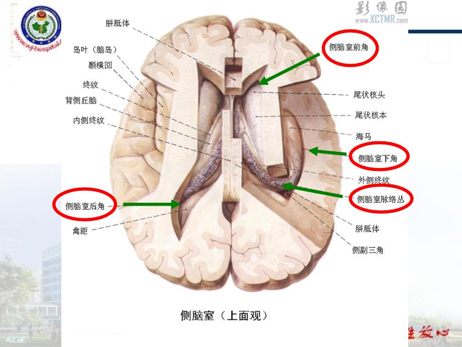 脑室系统解剖_第4页