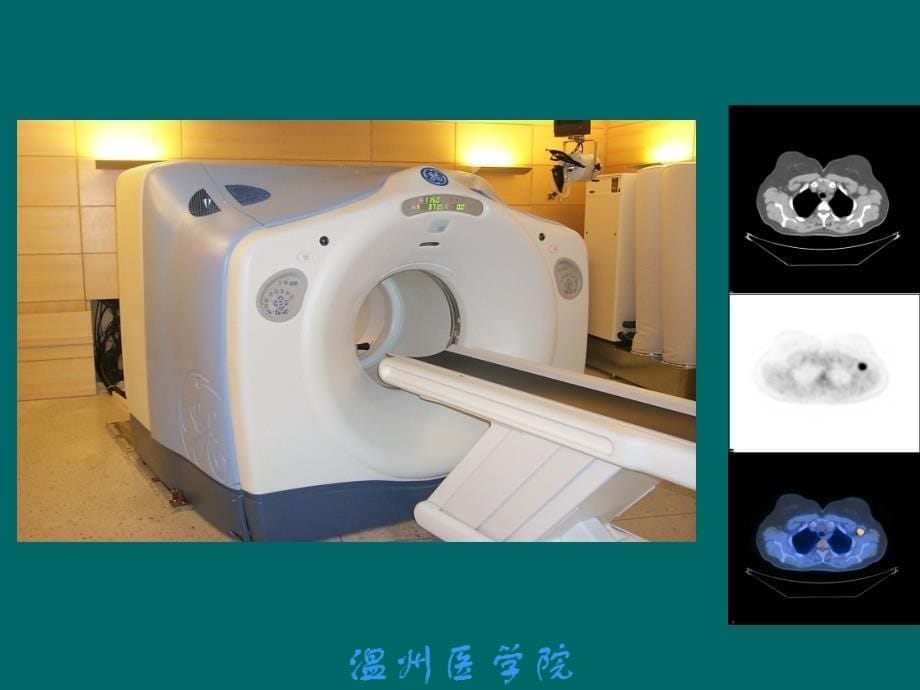 核医学：正电子核素显像_第5页