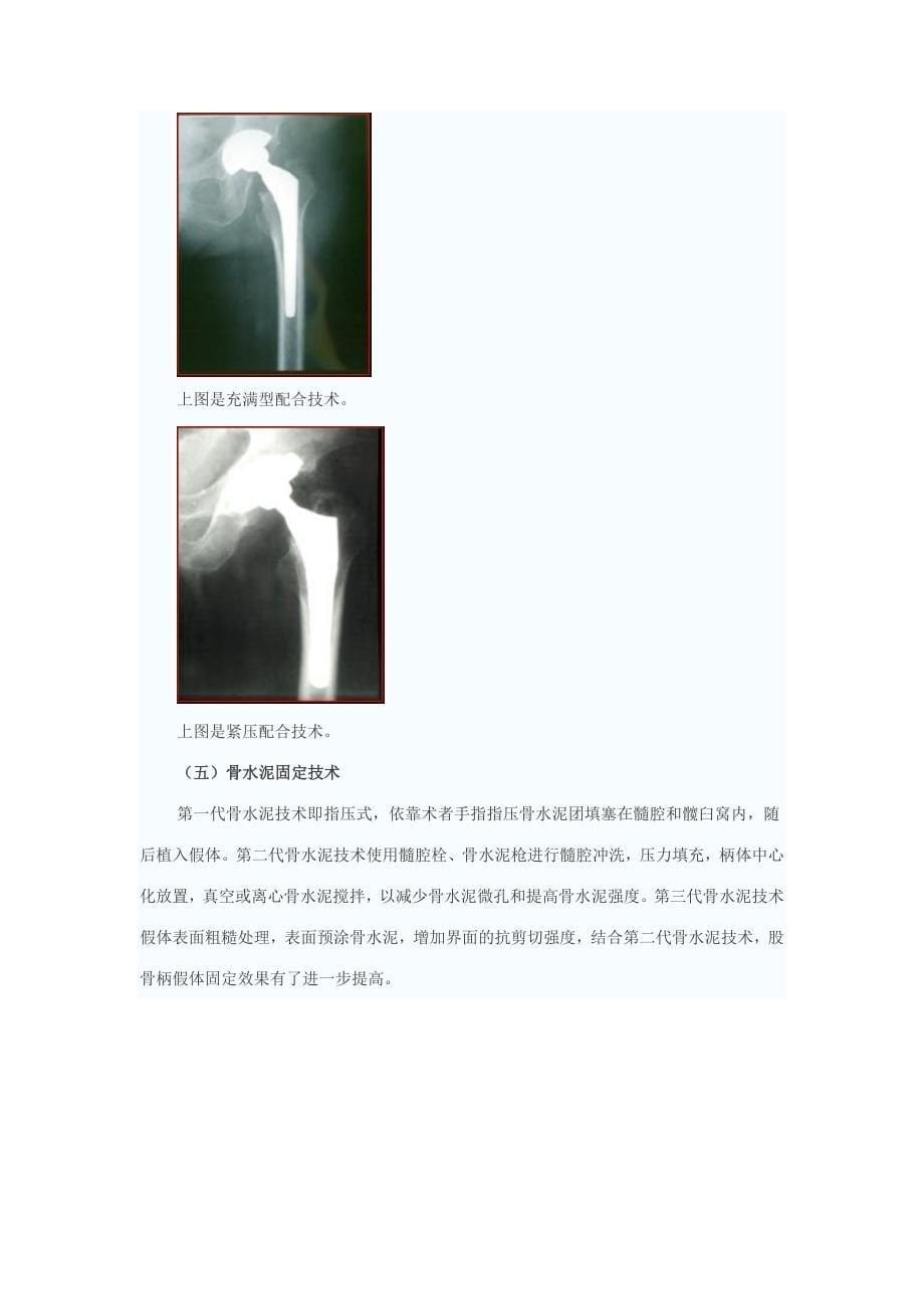 北京大学关节病研究所 关振鹏(精品)_第5页