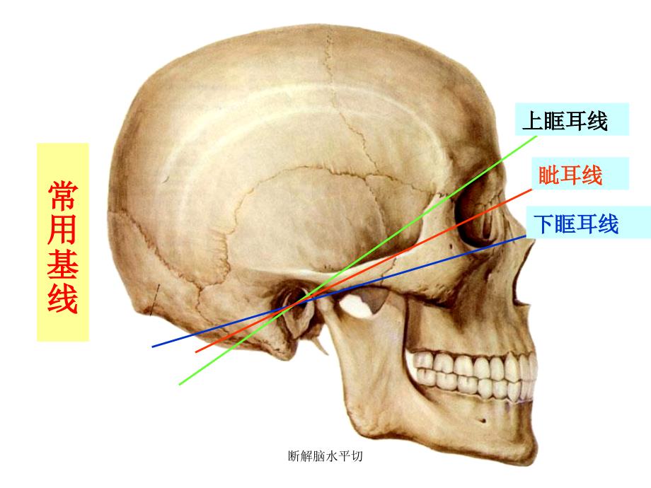 断解脑水平切课件_第3页