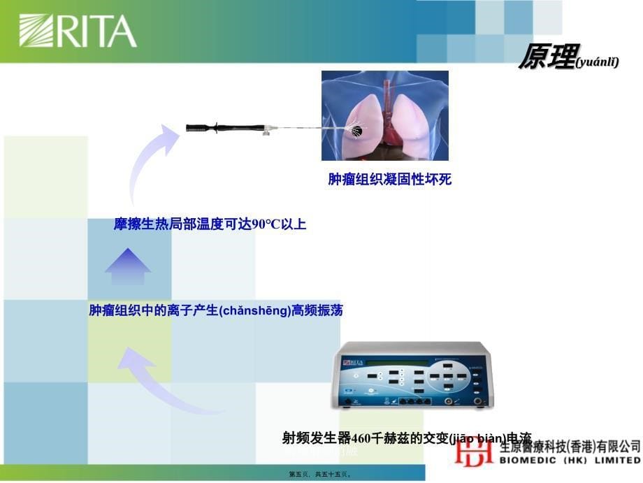 肺癌射频消融课件_第5页