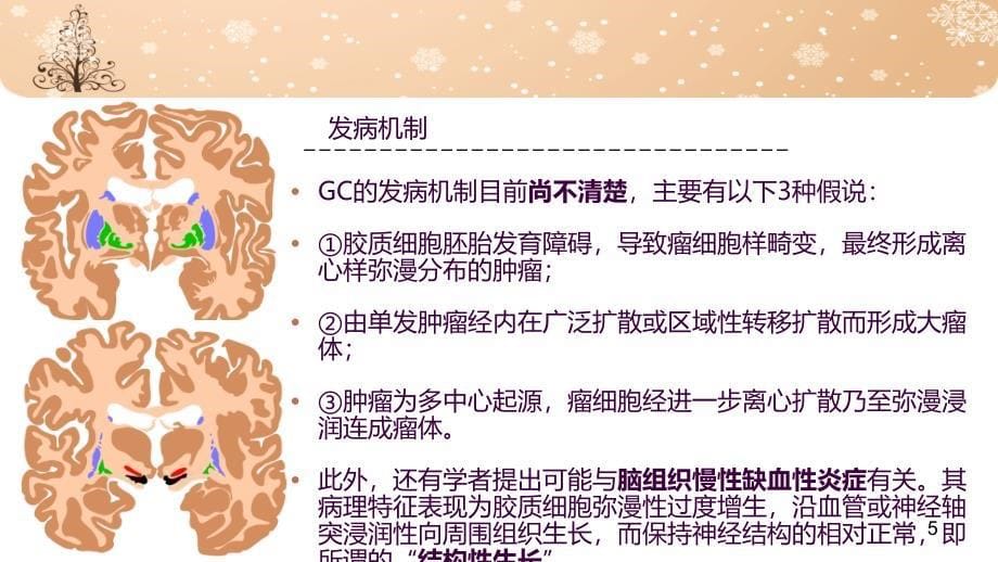 脑胶质瘤病影像学诊断ppt课件_第5页