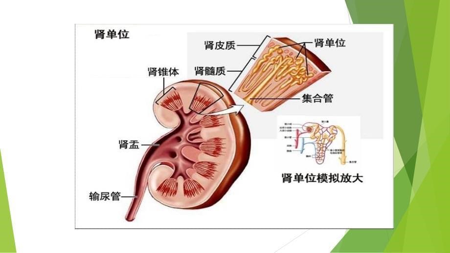 急性肾小球肾炎PPT_第5页