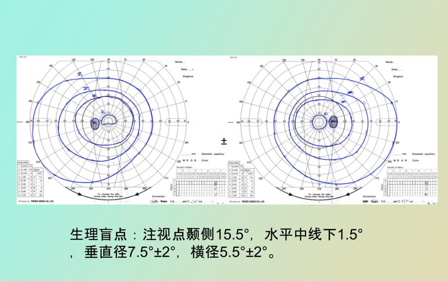 正常视野和病理性视野_第4页