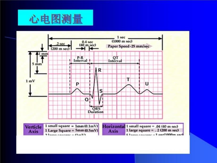 最新心电图岗前培训PPT课件_第3页