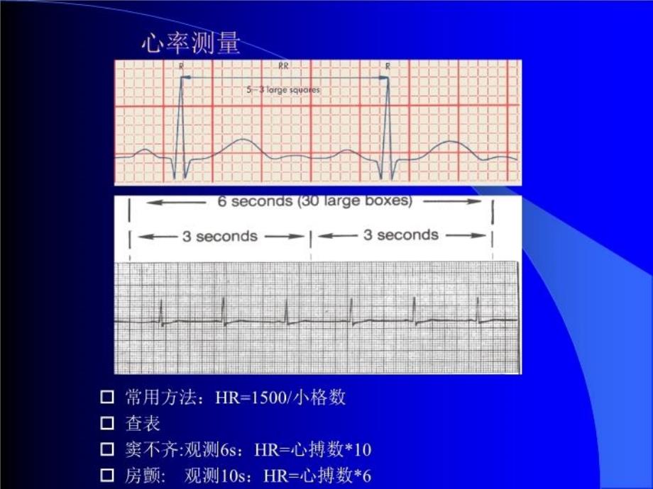 最新心电图岗前培训PPT课件_第4页