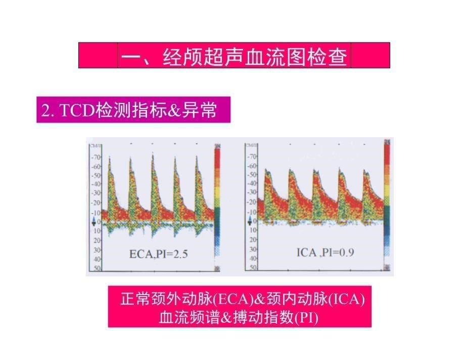 脑彩超基本知识_第5页