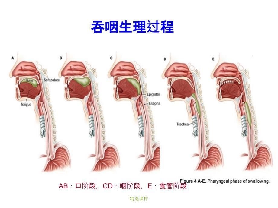 吞咽功能训练_第5页