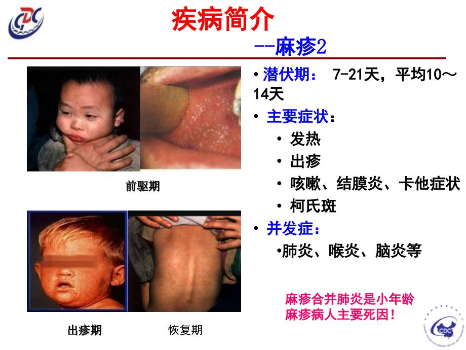 爱医资源-麻疹、风疹、腮腺炎的预防与控制_第4页