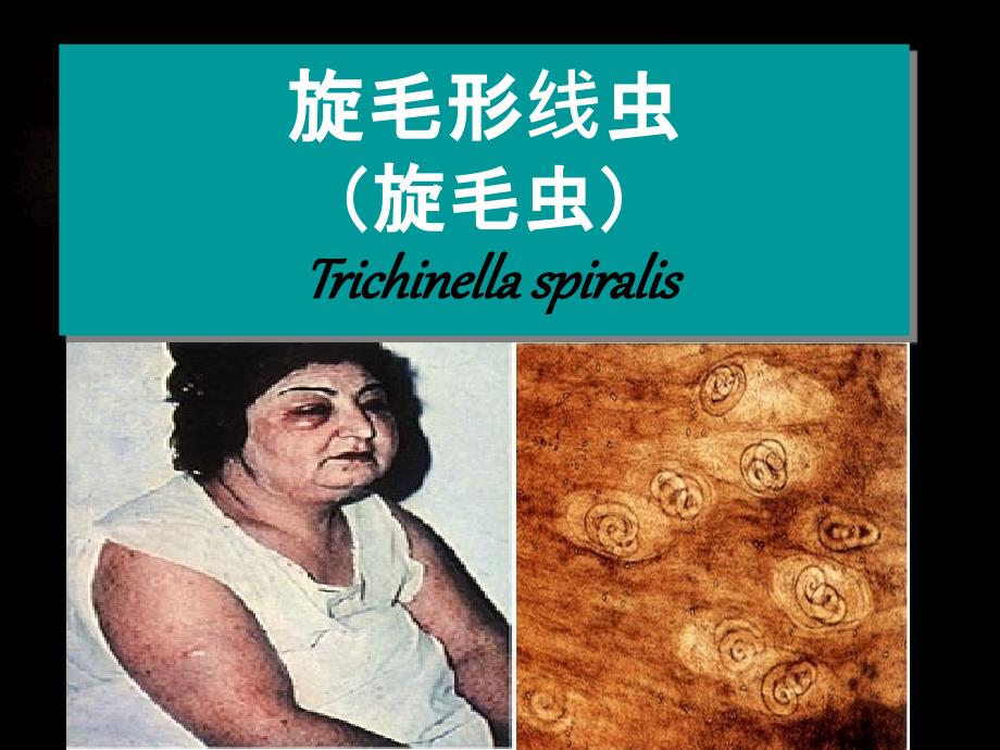4寄生虫学第四讲旋_第1页