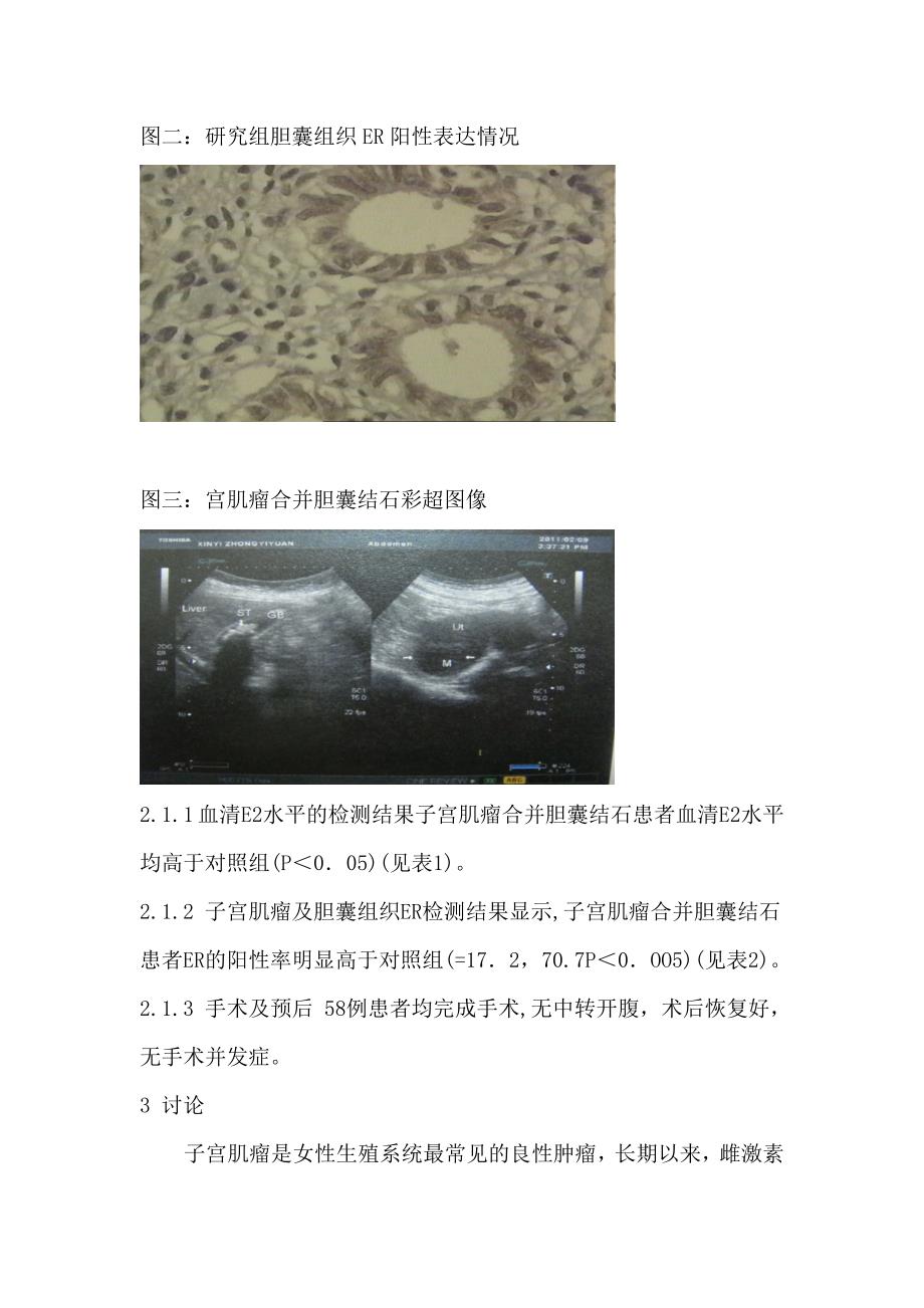 胆囊合并子宫2.doc_第5页