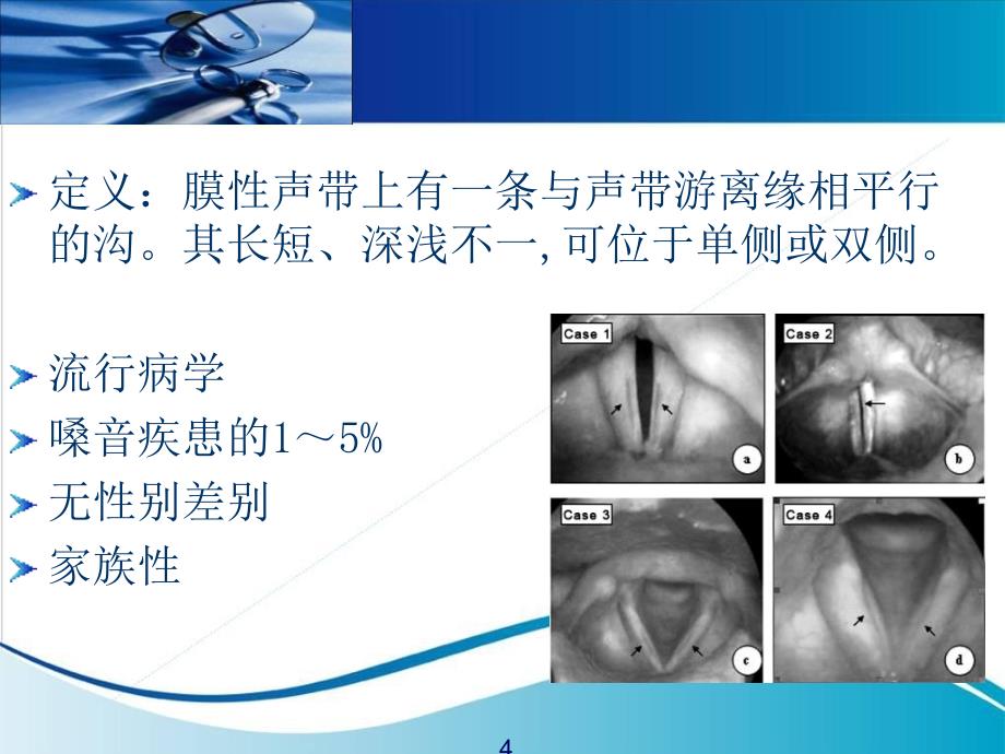 动态喉镜在声带沟的应用ppt课件_第4页