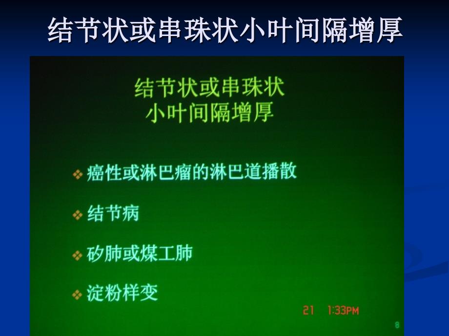 肺部HRCT十大常见征象分析课件_第3页