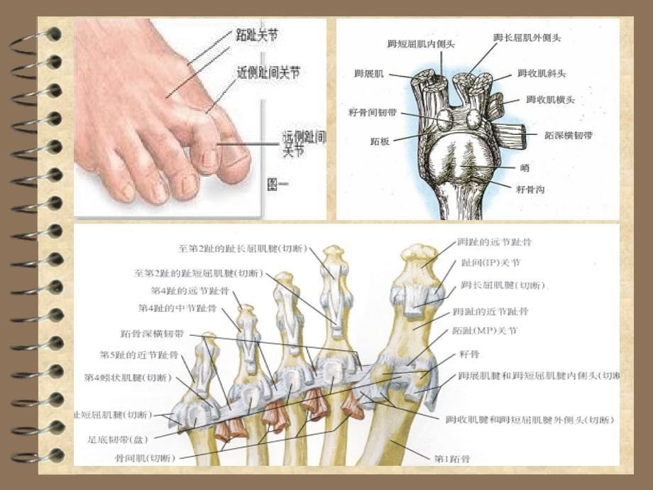 拇外翻修改版何晓霞_第5页