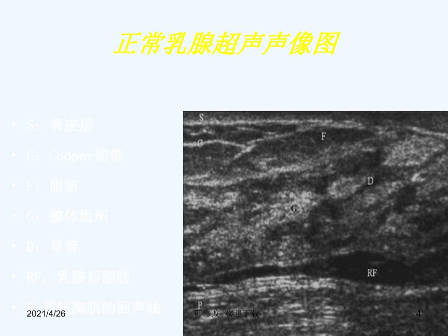 乳腺疾病超声诊断精品课件_第4页