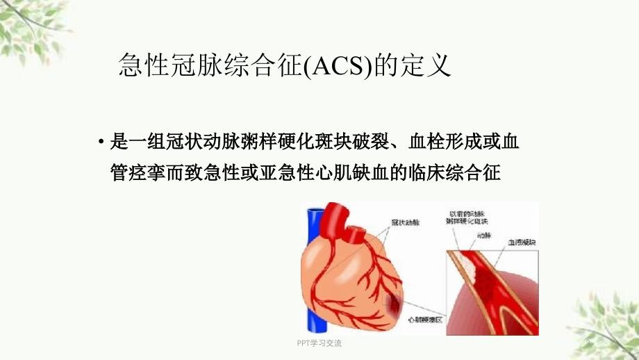 急性冠脉综合征的概念及护理ppt课件_第3页