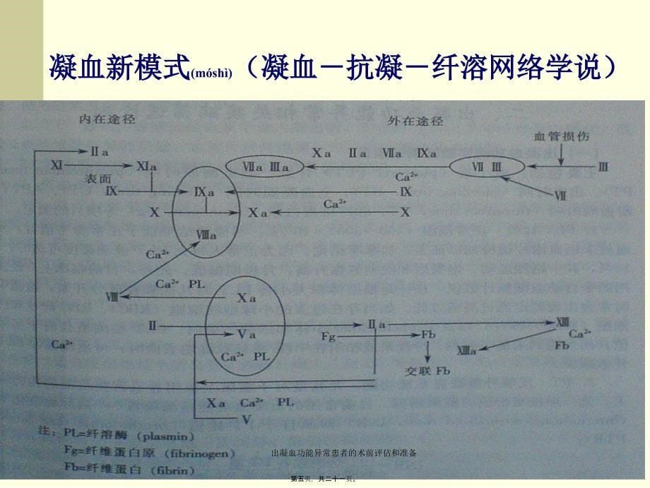 出凝血功能异常患者的术前评估和准备课件_第5页