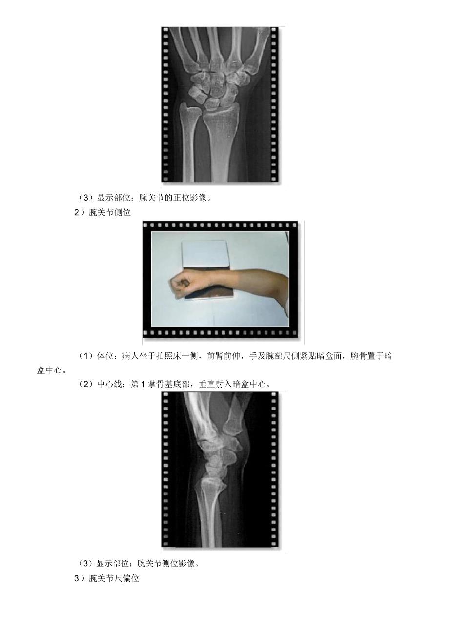 X线检查技术教学.doc_第4页