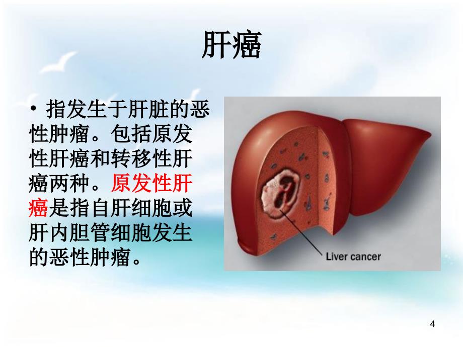 手术室护理查房ppt课件.ppt_第4页