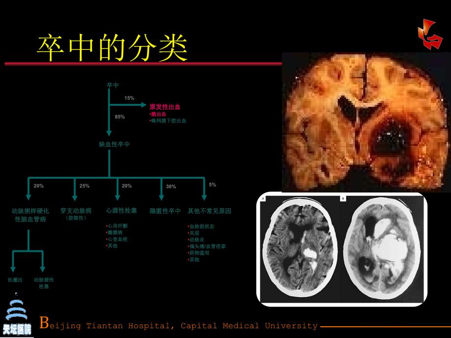 缺血性卒中的抗栓治疗_第3页