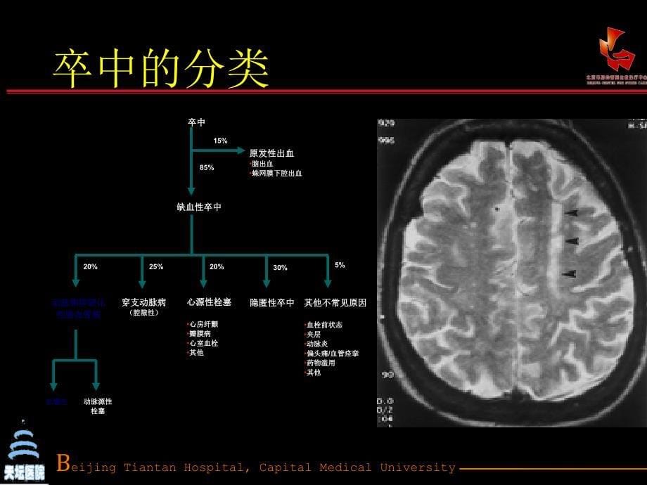 缺血性卒中的抗栓治疗_第5页