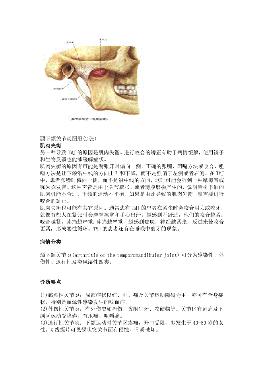 颞下颌关节炎.doc_第2页