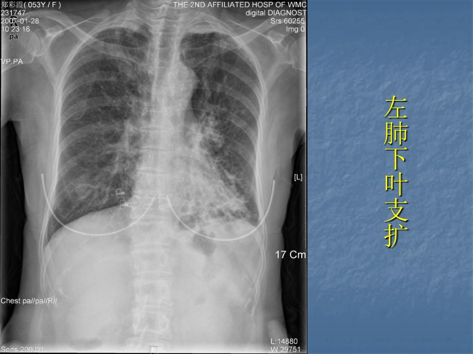 医学影像学：胸部常见病的影像诊断_第4页