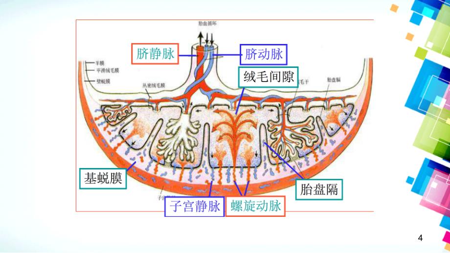 胎盘植入影像学表现优秀课件_第4页