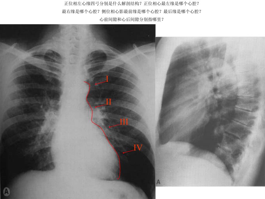 循环系统正常影像学现及基本病变 PP课件_第2页