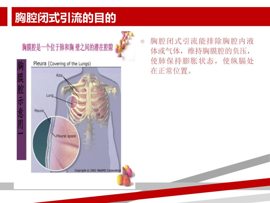 胸腔闭式引流的护理及注意事项.ppt课件_第3页