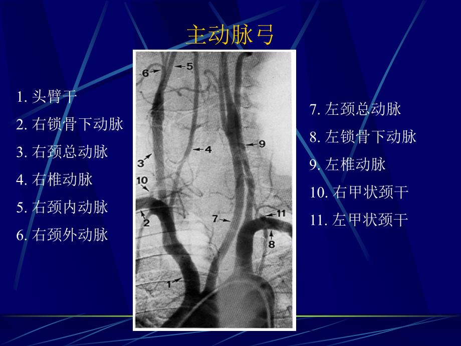 脑血管解剖及造影术_第3页