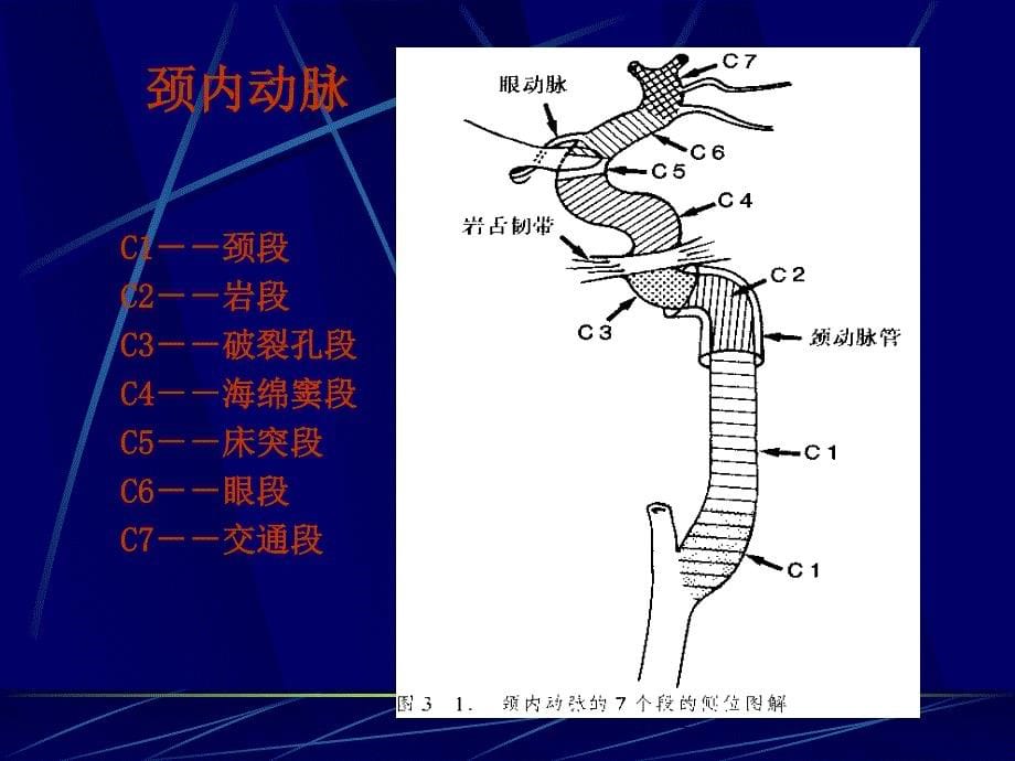 脑血管解剖及造影术_第5页