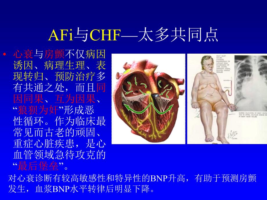 af对chf预后的影响和干预郭涛_第2页