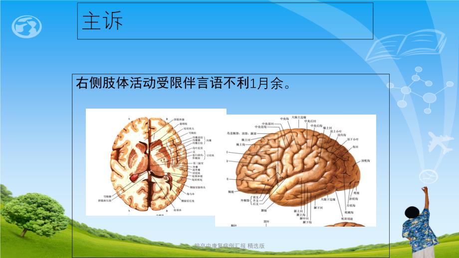 脑卒中康复病例汇报 精选版ppt课件_第3页