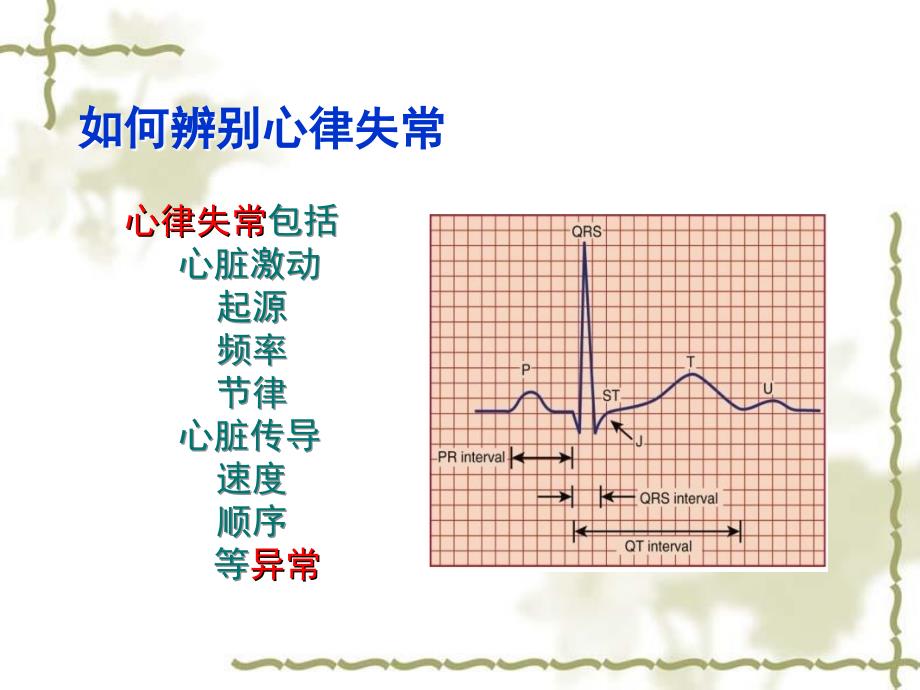 麻醉中心律失常的处理_第4页