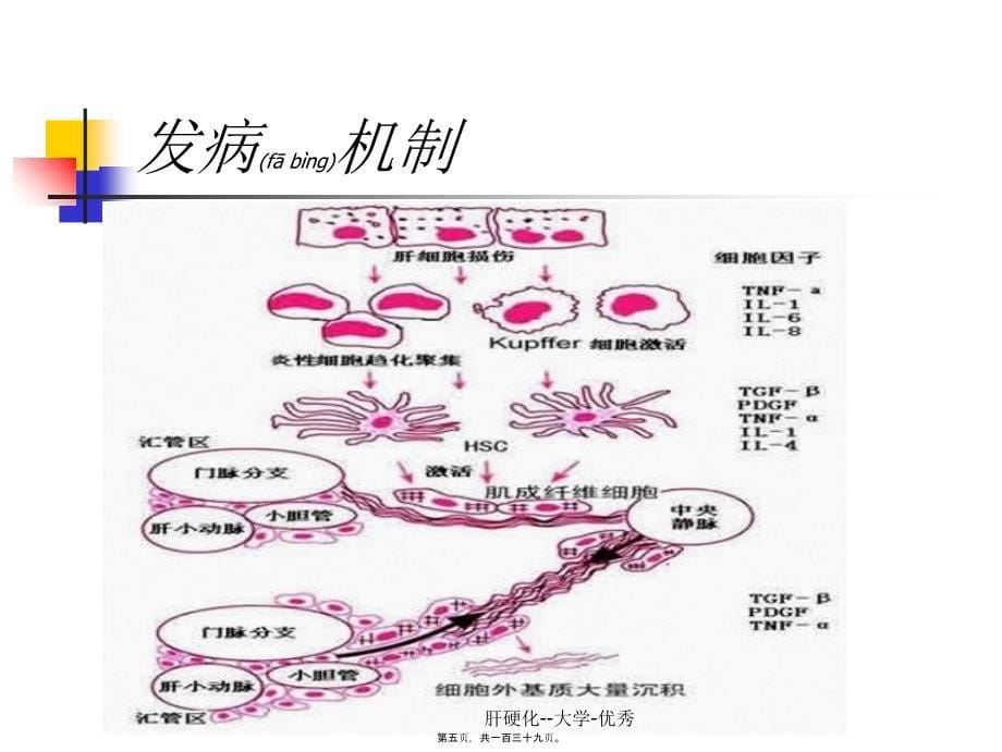 肝硬化大学优秀课件_第5页