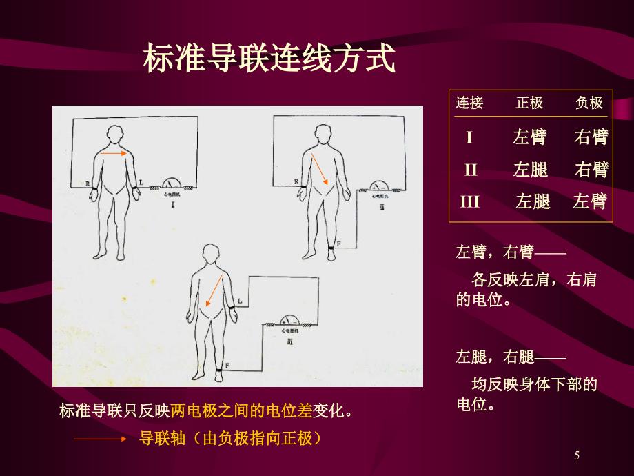 心电图心电向量与心肌缺血_第4页