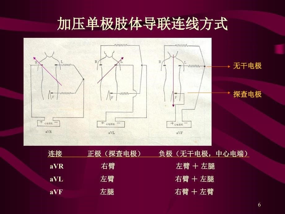 心电图心电向量与心肌缺血_第5页