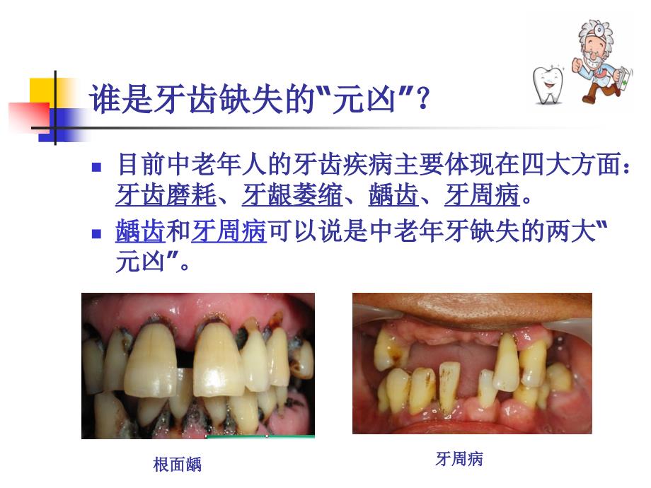 口腔科——中老年科普知识讲座课件_第3页