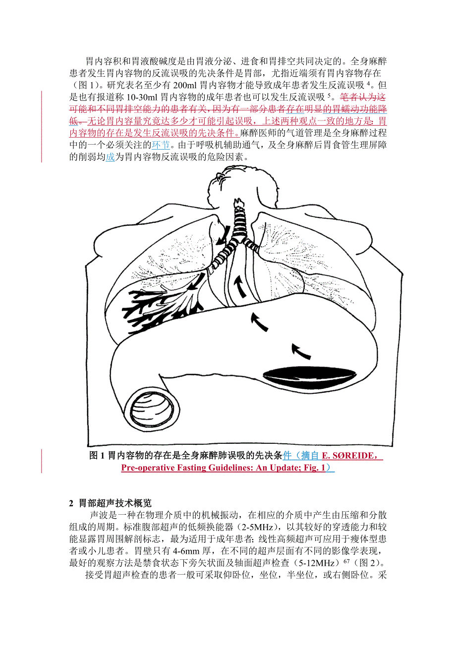 床边超声评估手术患者胃内容物的研究进展_第3页