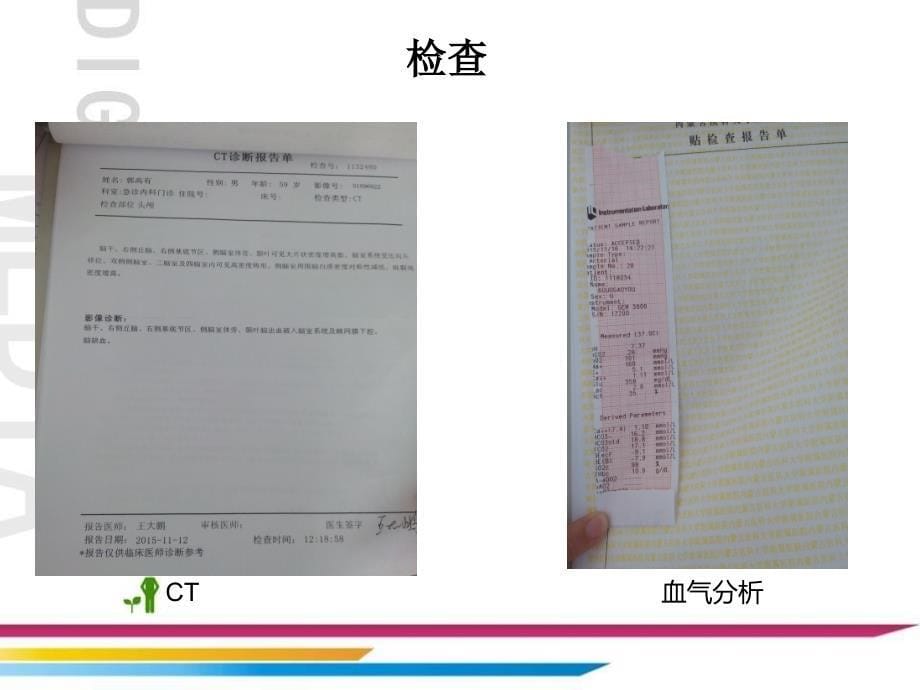 一例高血压脑出血护理查房_第5页