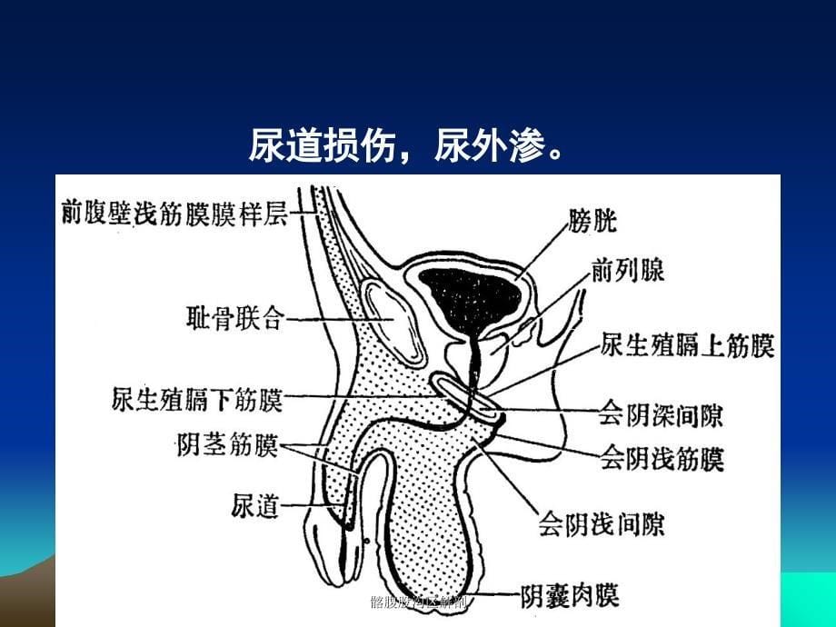 最新髂腹股沟区解剖_第5页